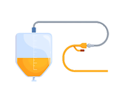 膀胱留置カテーテル